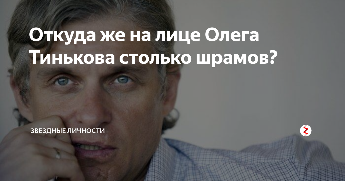 Олег Тиньков в молодости шрам. Олег Тиньков шрам. Олег Тиньков шрамы на лице. Шрам Олега Тинькова.