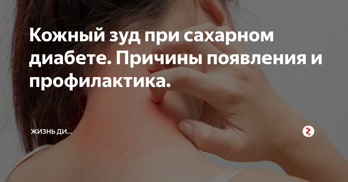 Крем для рук для диабетиков диадерм. Крем диадерм для диабетиков регенерирующий. Сахарный диабет проявления на коже. Зуд кожи при сахарном диабете 2 типа. Мазь для диабетиков от чесания.