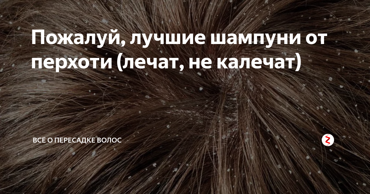 Народные средства от перхоти. Народные средства от перхоти в домашних. Перхоть народные средства. Народные средства от перхоти на голове.