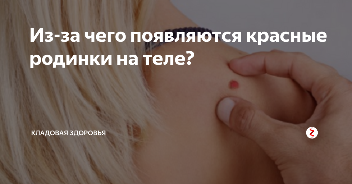 Родинка у подростка - Вопрос дерматологу - 03 Онлайн