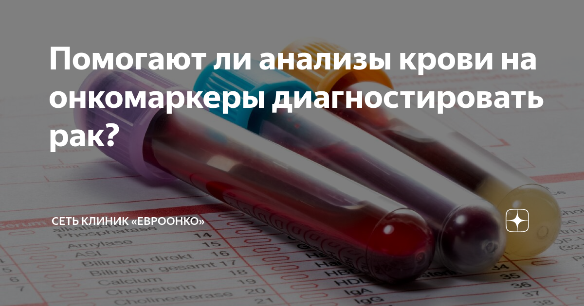 Помогают ли анализы крови на онкомаркеры диагностировать рак? | Сеть ...