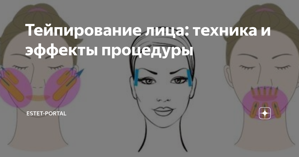 Тейпирование овала лица схемы