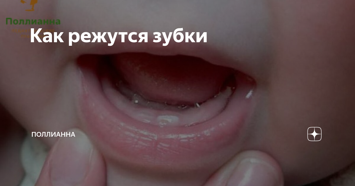 как успокоить малыша когда режутся зубки