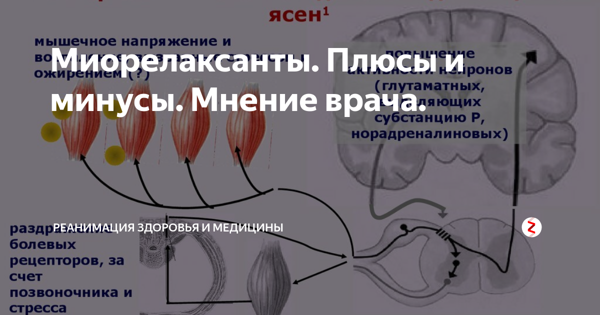 Миорелаксанты при остеохондрозе поясничного отдела Миорелаксанты при остеохондрозе поясничного отдела