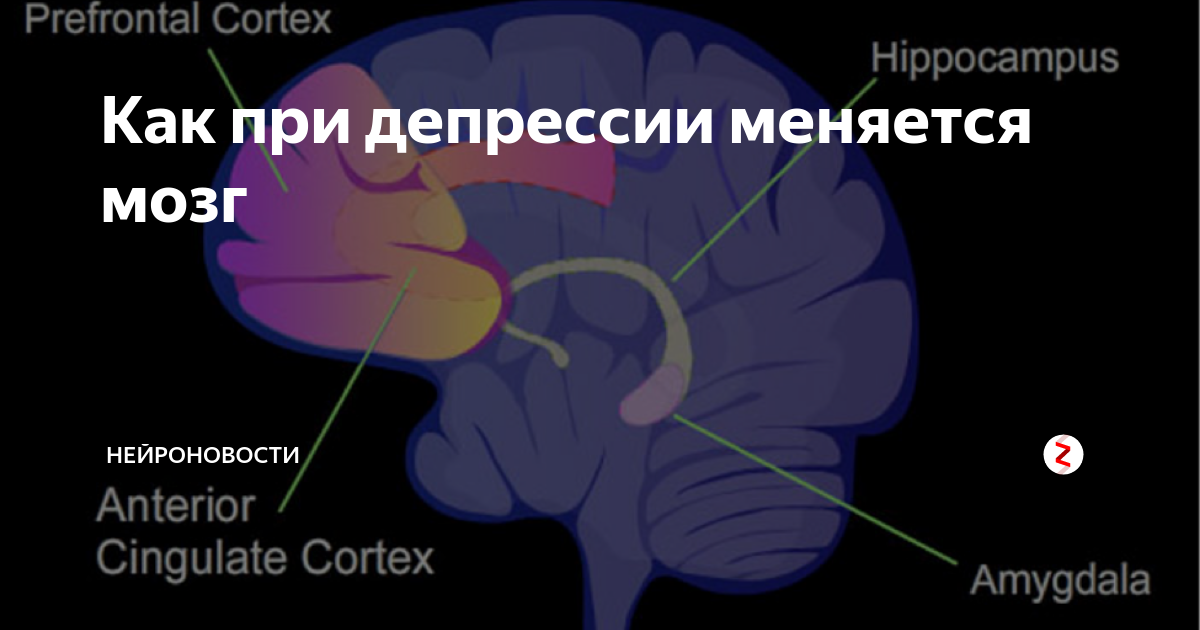 Мозг при депрессии. Головной мозг при депрессии. Мозг человека с депрессией. Снимки мозга при депрессии.