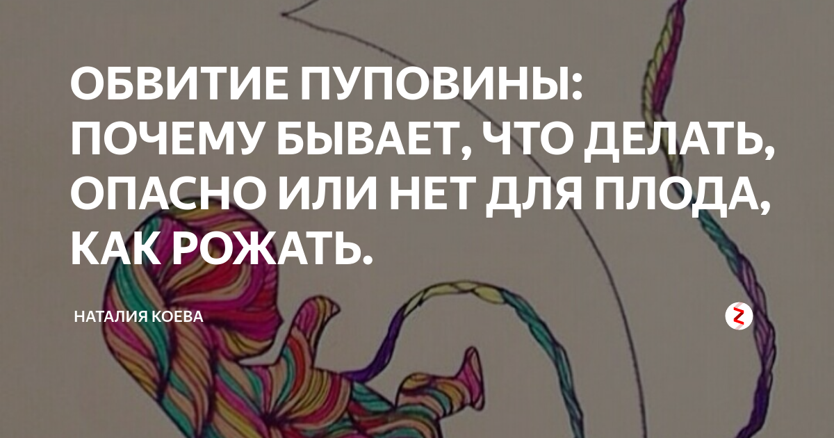 однократное обвитие опасно ли. 1 петля пуповины у шеи плода. уз-допплерография маточно-плацентарного кровотока. однократное обвитие шеи пуповиной. двойное обвитие пуповиной вокруг шеи.