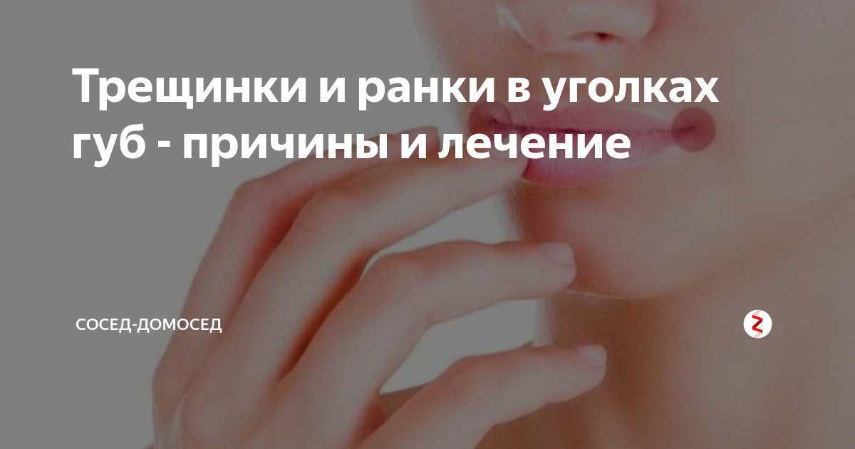 Почему бывают трещины и заеды в уголках рта - статьи astudiomebel.ru