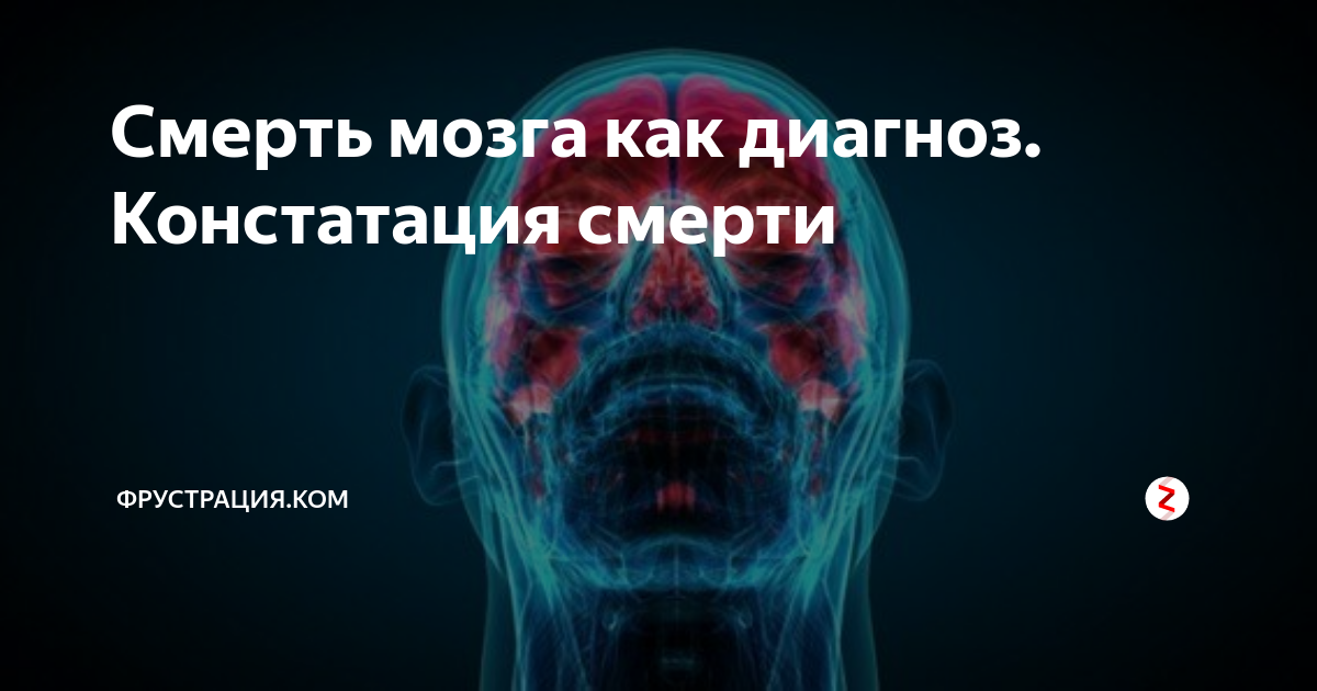 Кома мозг умирает. Смерть мозга. Назовите исследование констатирующее смерть мозга. Смерть мозга клинические рекомендации.