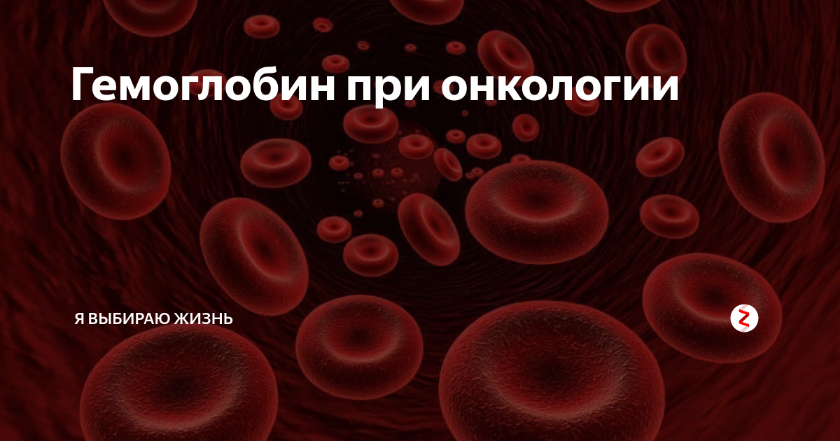 Гемоглобин при онкологии. Показатели гемоглобина при онкологии. При гемоглобине. Онкологическое заболевание гемоглобин.