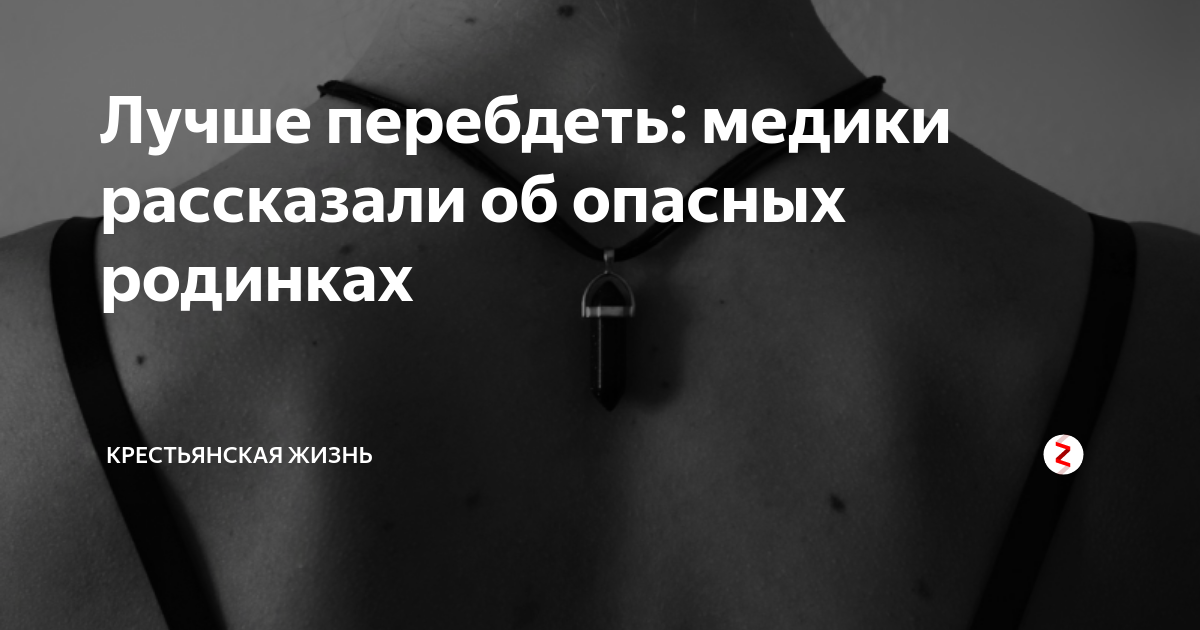 Перебдеть. Перебдеть