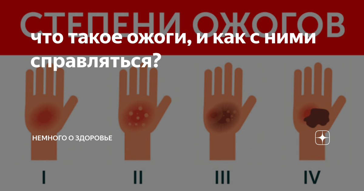 Ожог по эзотерике: смысл и значение