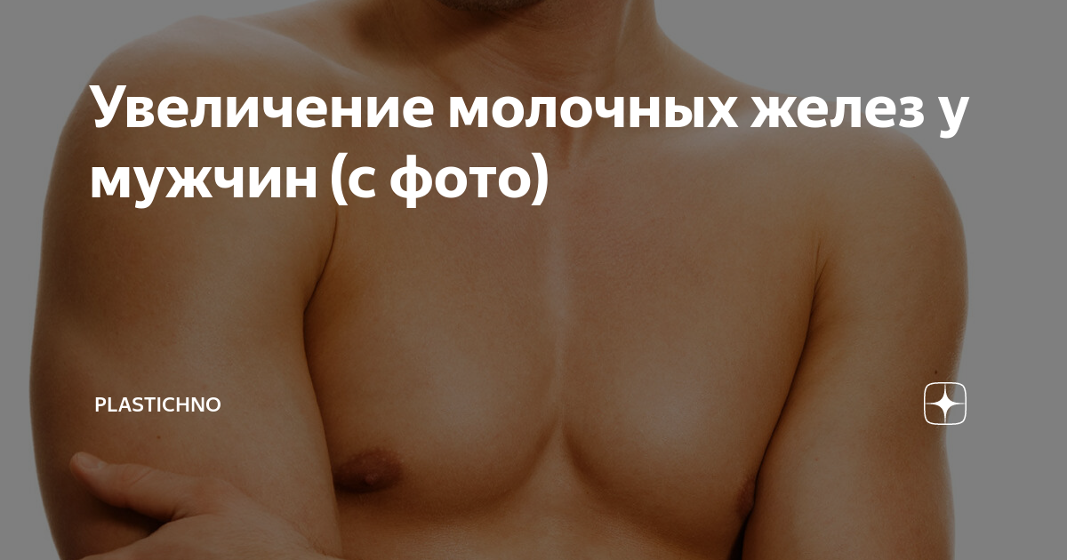 гипертрофия молочной железы у мужчин. гипертрофия молочной железы у мужчин. сыроедческая гинекомастия. гинекомастия ранняя стадия. трансгендерная гинекомастия.