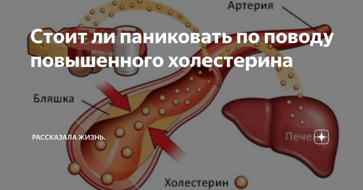 Симптомы повышенного холестерина. Симптомы высокого холестерина. Высокий холестерин у мужчин симптомы. Симптомы высокого холестерина в крови у мужчин
