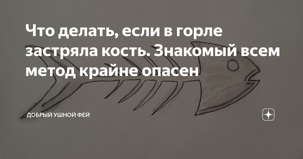 Хирург рассказал, что нельзя делать, если в горле застряла рыбная кость - domkulinari.ru | Новости