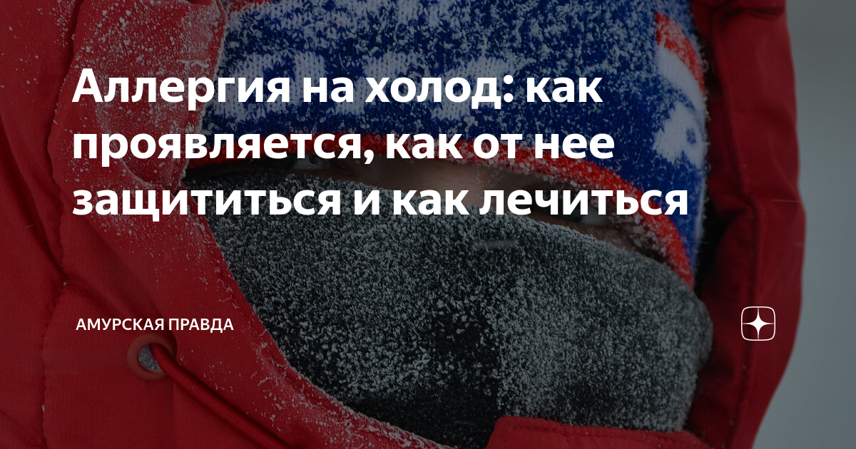 Холодовая аллергия — cимптомы, причины возникновения и способы лечения