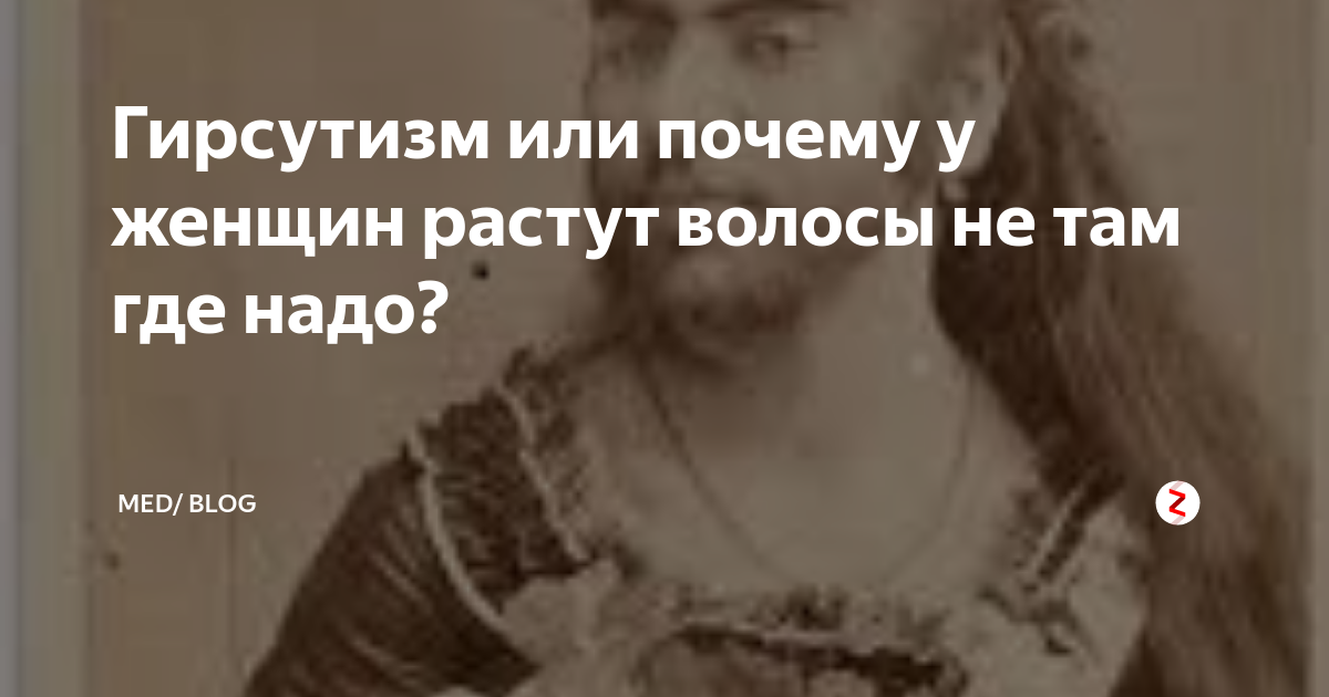 Гирсутизм или почему у женщин растут волосы не там где надо? | Med ...