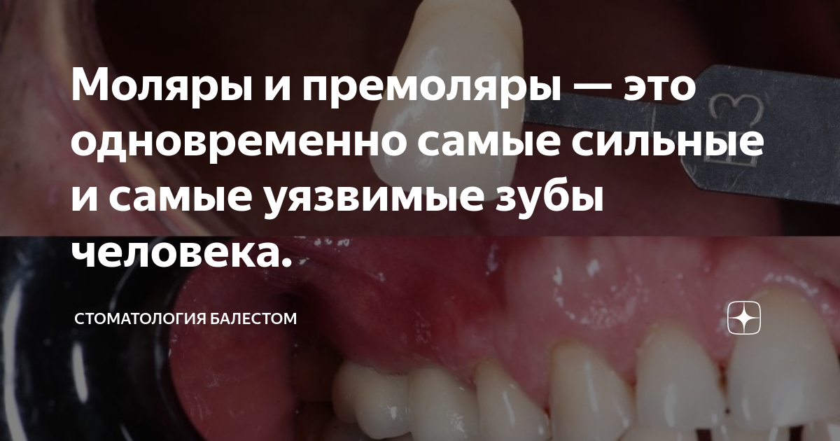 Нумерация (номера) зубов в стоматологии – схема у взрослых, как считать зубы по номерам