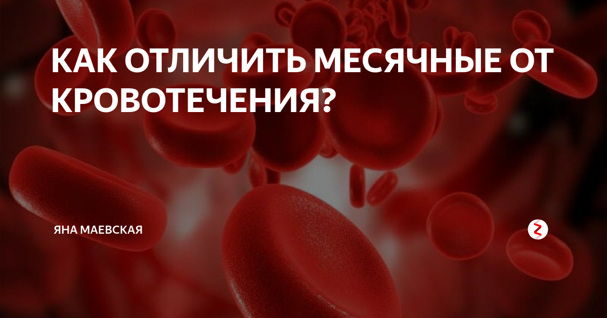 Обильные месячные отзывы. Обильные менструальные кровотечения. Как отличить месячные от кровотечения. Как отличить кровотечение от месячных. Отличие месячных от кровотечения.