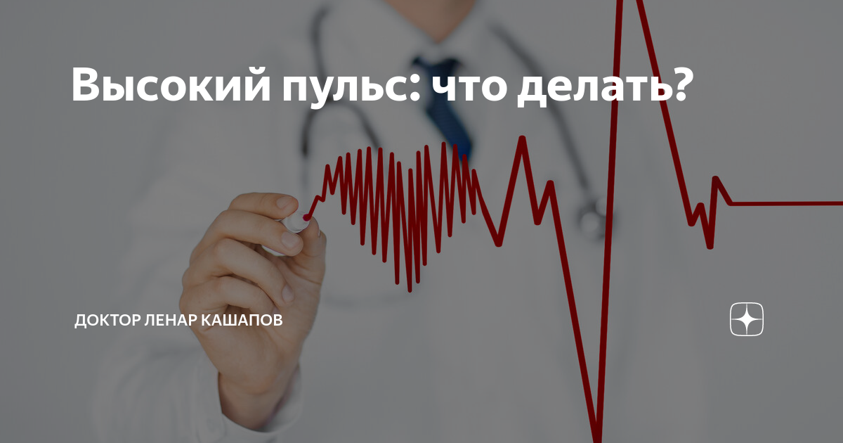 Высокий пульс читать. Высокий пульс. Высокое сердцебиение. Если повышенный пульс. Высокий пульс что делать.