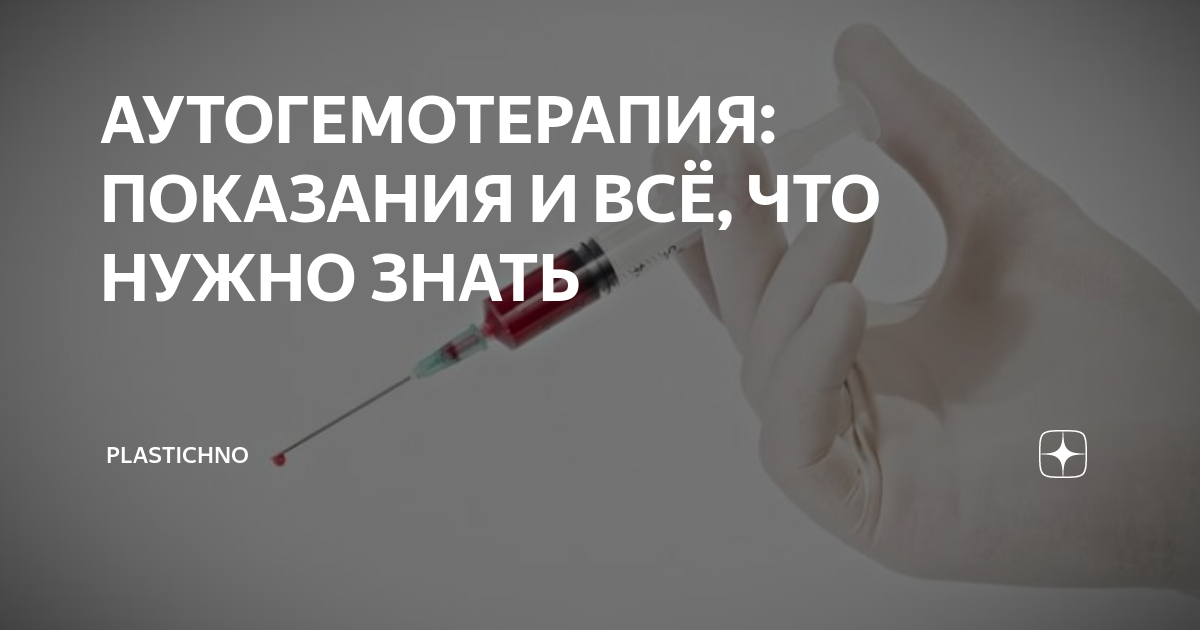 Аутогемотерапия схема. Аутогемотерапия. Аутогемотерапия в Москве. Аутогемотерапия отзывы. Аутогемотерапия схема для детей.
