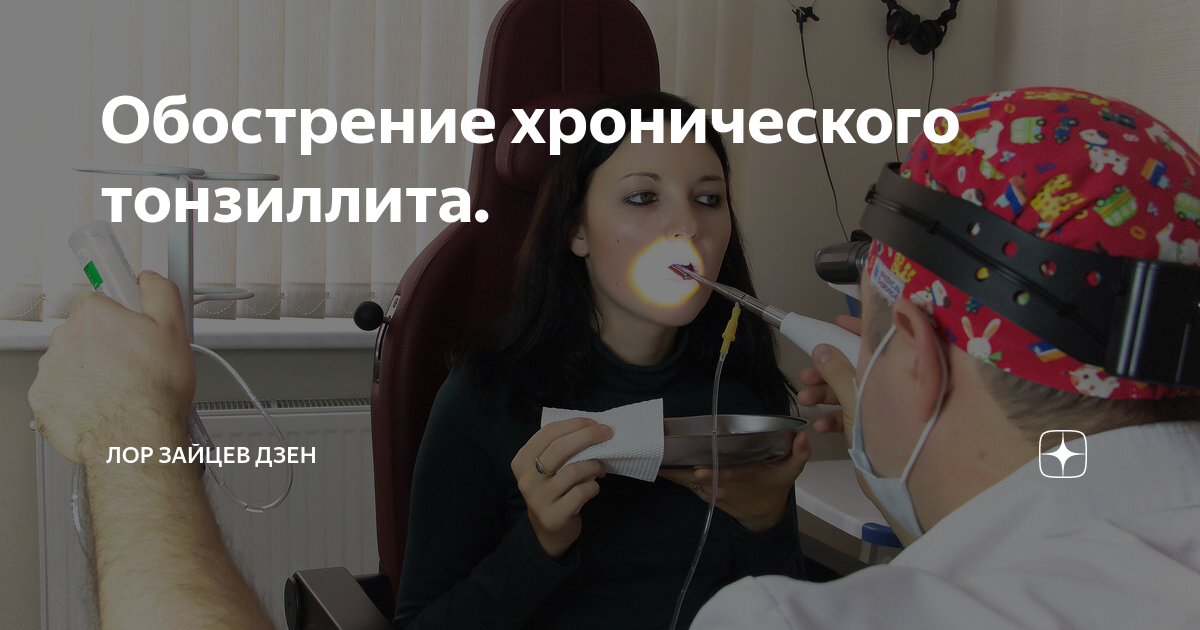 Обострение хронического тонзиллита. | ЛОР КЛИНИКА ЗАЙЦЕВА | Дзен