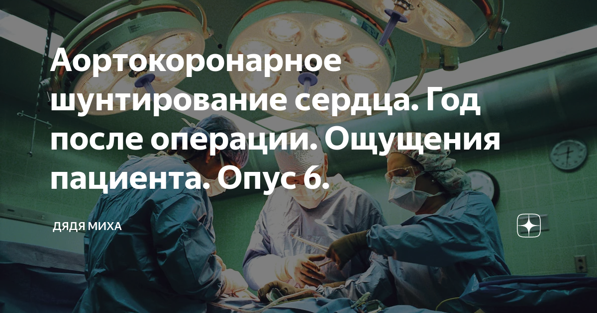 Операция аортокоронарного шунтирования. Операция на сердце шунтирование. После шунтирования сердца. Шунтирование сердца фото.