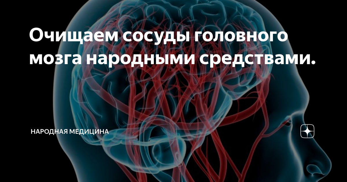 Атеросклероз головного мозга народное лечение. Упражнения для сосудов головы. Гимнастика для сосудов головного мозга. Упражнения для сосудов головного мозга и шеи.