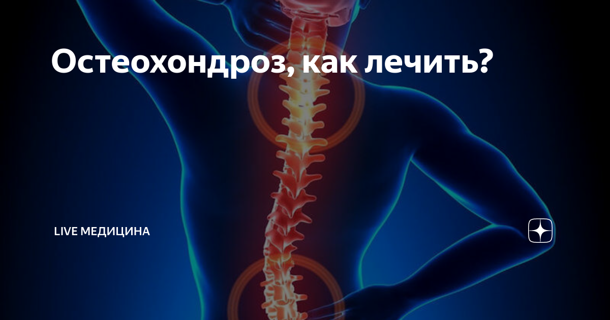 Остеохондроз после 40 лет. Как лечить остеохондроз. Регенерация остеохондроз. Остеохондроз Мем. Как лечится остеохондроз.