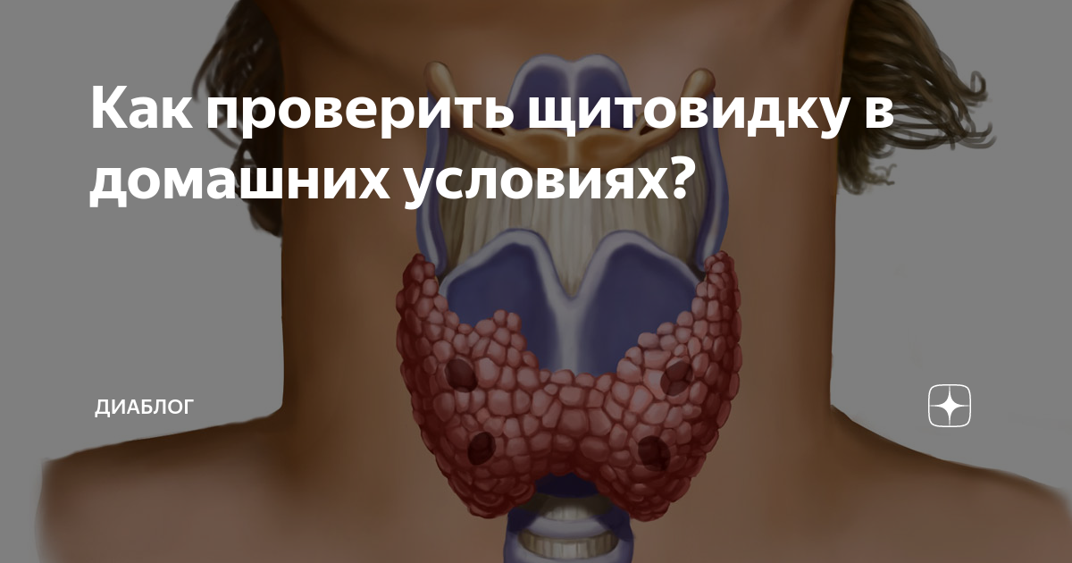 Как проверить щитовидную железу. Щитовидная железа симптомы. Щитовидная железа в форме бабочки. Узловой зоб щитовидной железы. Щитовидная железа симптомы щитовидной железы.