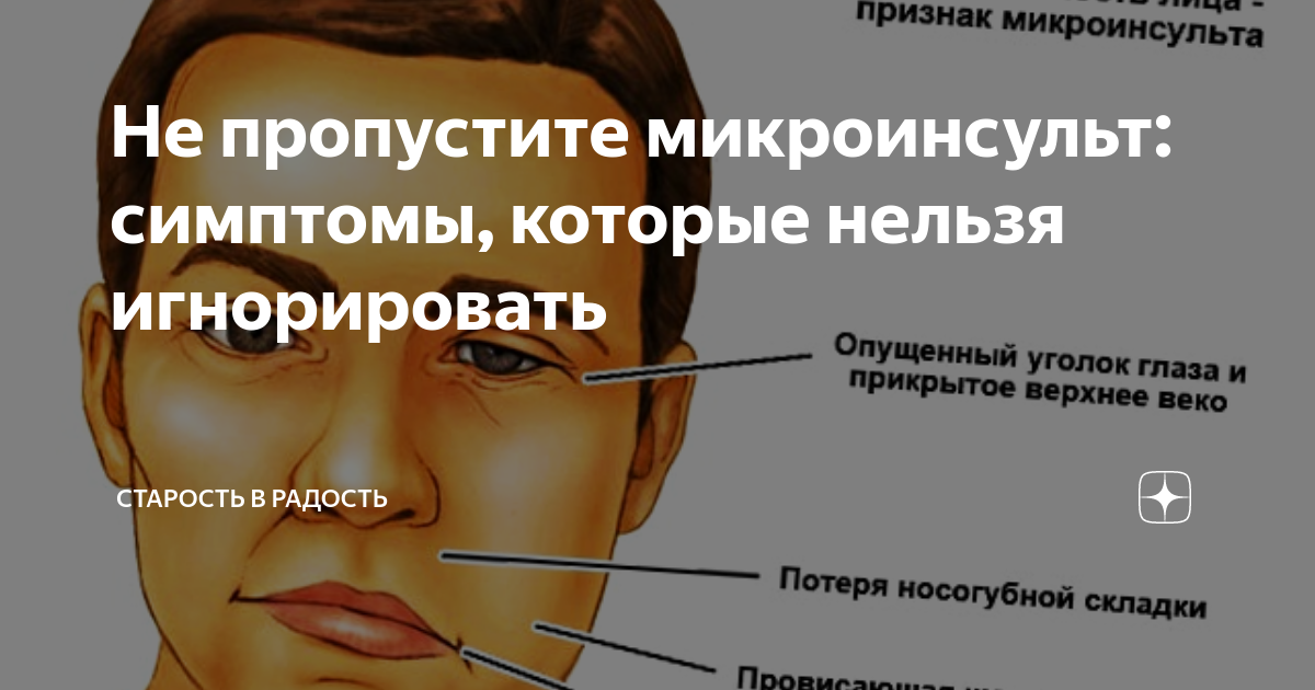 Микроинсульт симптомы первые