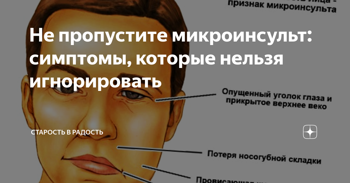 Микроинсульт это