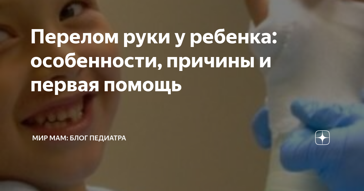Перелом руки у ребенка: особенности, причины и первая помощь | Мир мам ...