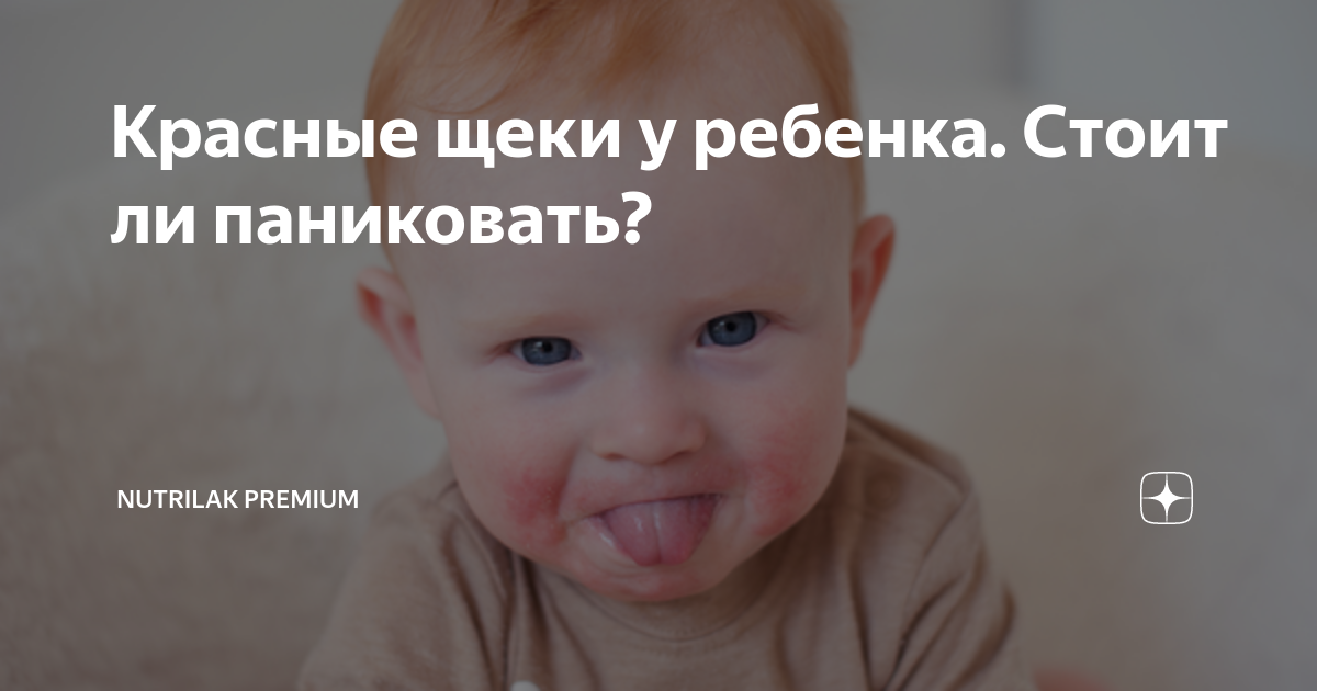 Красные щеки и переход на ИВ — 25 ответов | форум Babyblog