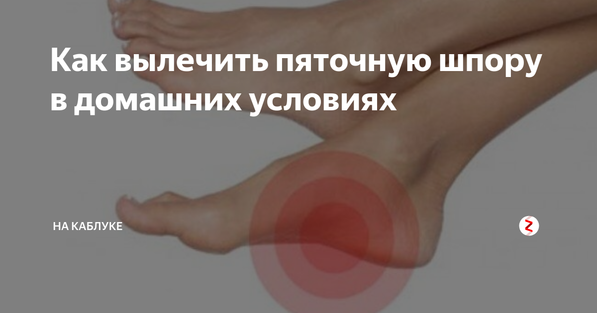 Пяточная шпора симптомы Пяточная шпора симптомы