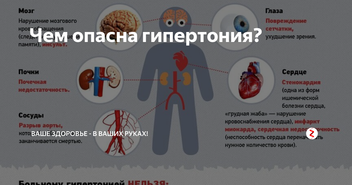Гипертония симптомы. Инсульт при гипертонической болезни. Гипертония симптомы у женщин. Чем опасна гипертония. Гипертонический криз инсульт