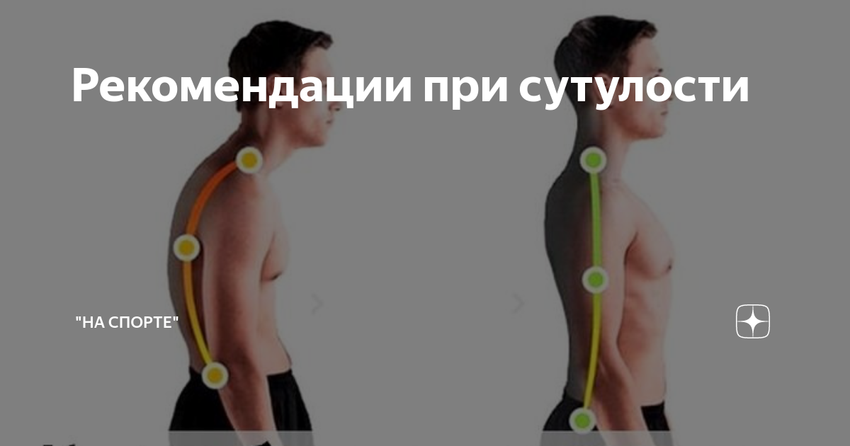 Упражнения против сутулости спины. Можно ли исправить сутулость. Упражнения для спины для исправления осанки. Рекомендации по сутулости. Мышцы спины осанка сутулость.