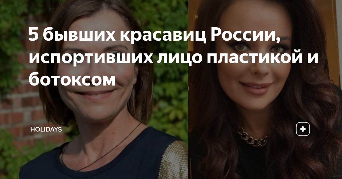 Екатерина Стриженова: фото после пластики и ботокса