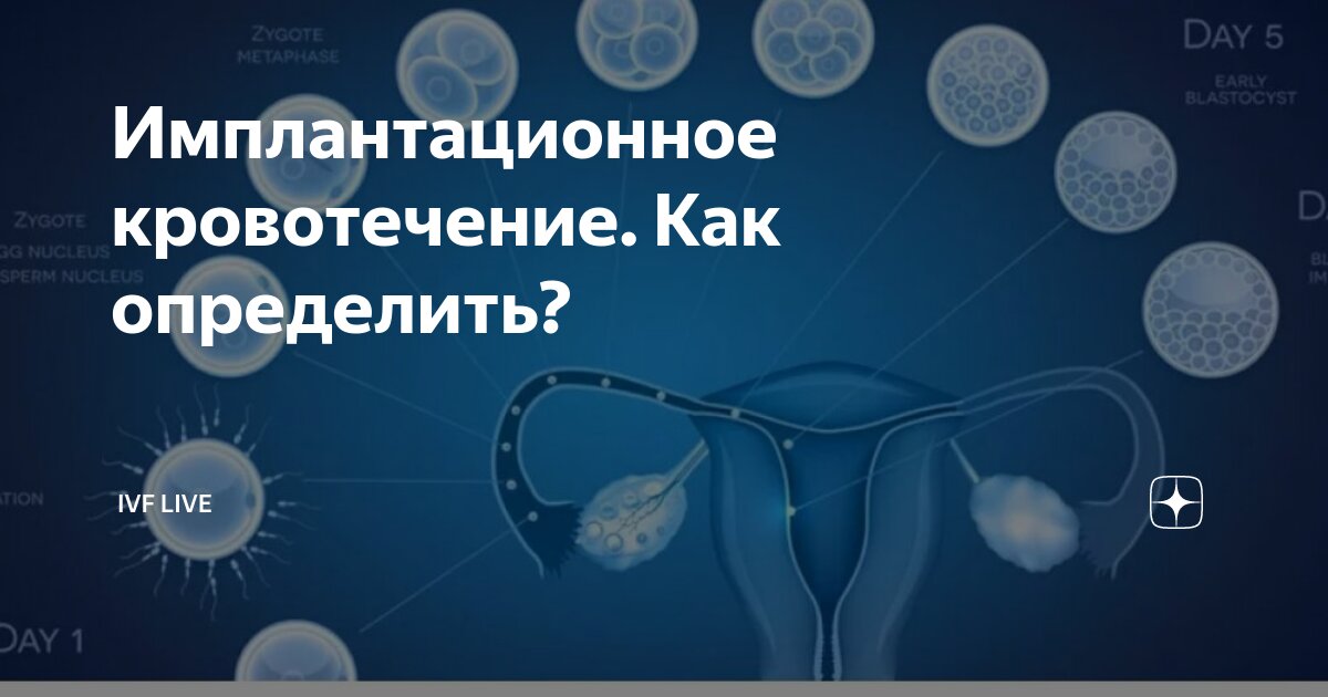 Кровь в начале беременности? Без паники! Что такое имплантационное кровотечение