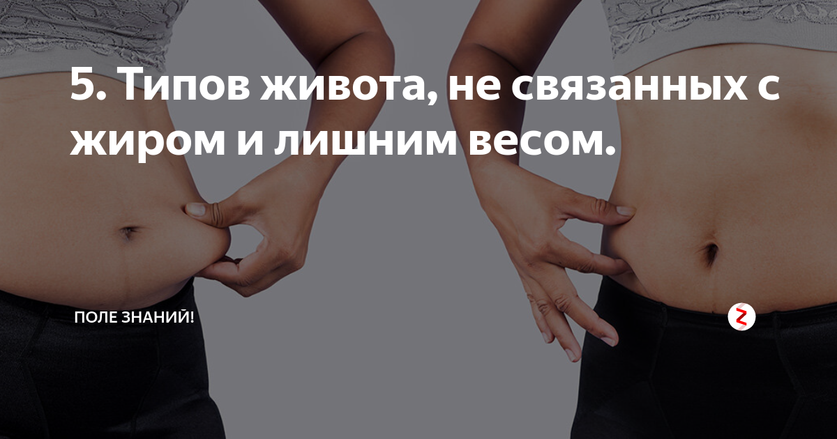 Типы живота. Типы Животов у мужчин. Типы живота при лишнем весе. 4 Типа живота.