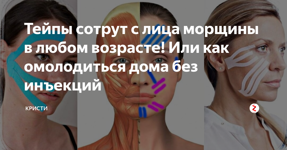 Тейпы на носогубные складки схема