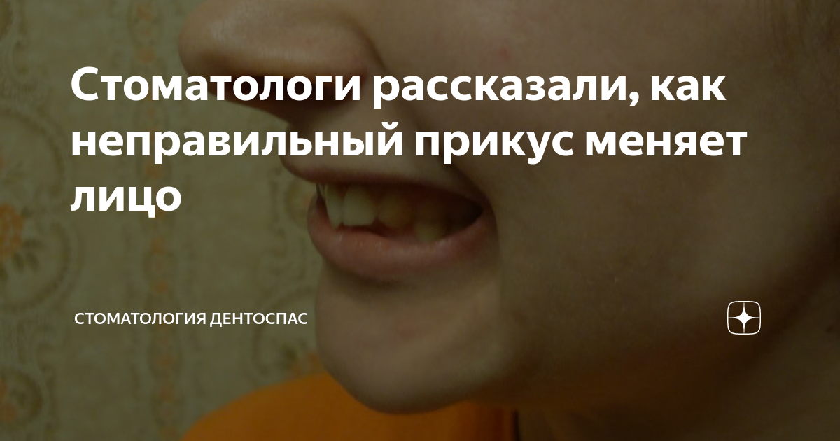 Стоматологи рассказали, как неправильный прикус меняет лицо ...