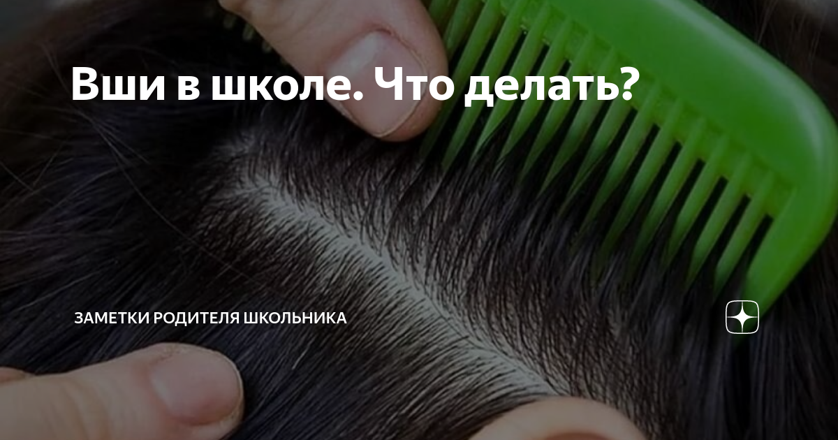 Осмотр головы у детей. Вши в школе что делать. Волосы для детей. Вши в школе что делать. Вши в школе что делать.