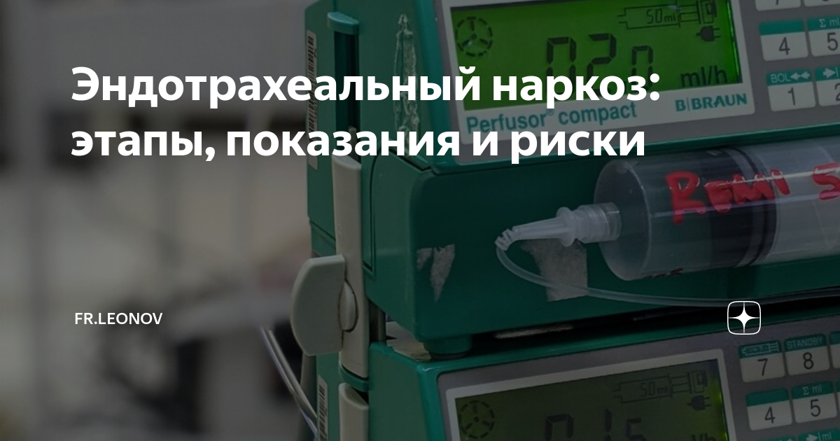 Эндотрахеальный наркоз: этапы, показания и риски | fr.leonov | Дзен