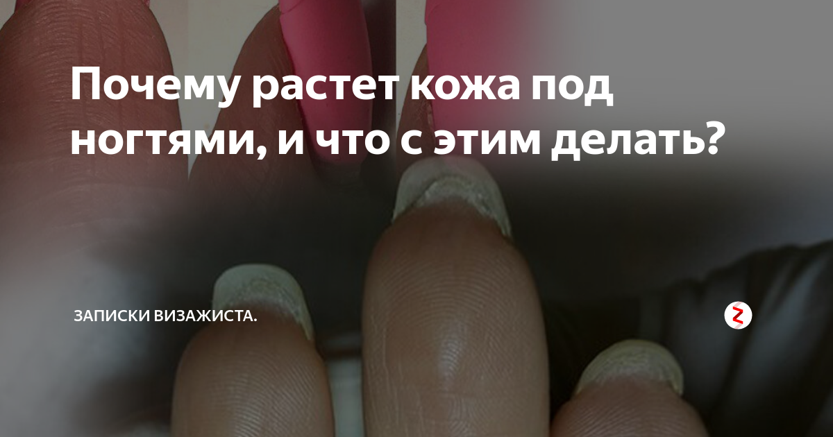 пустота и зелень под ногтем форум