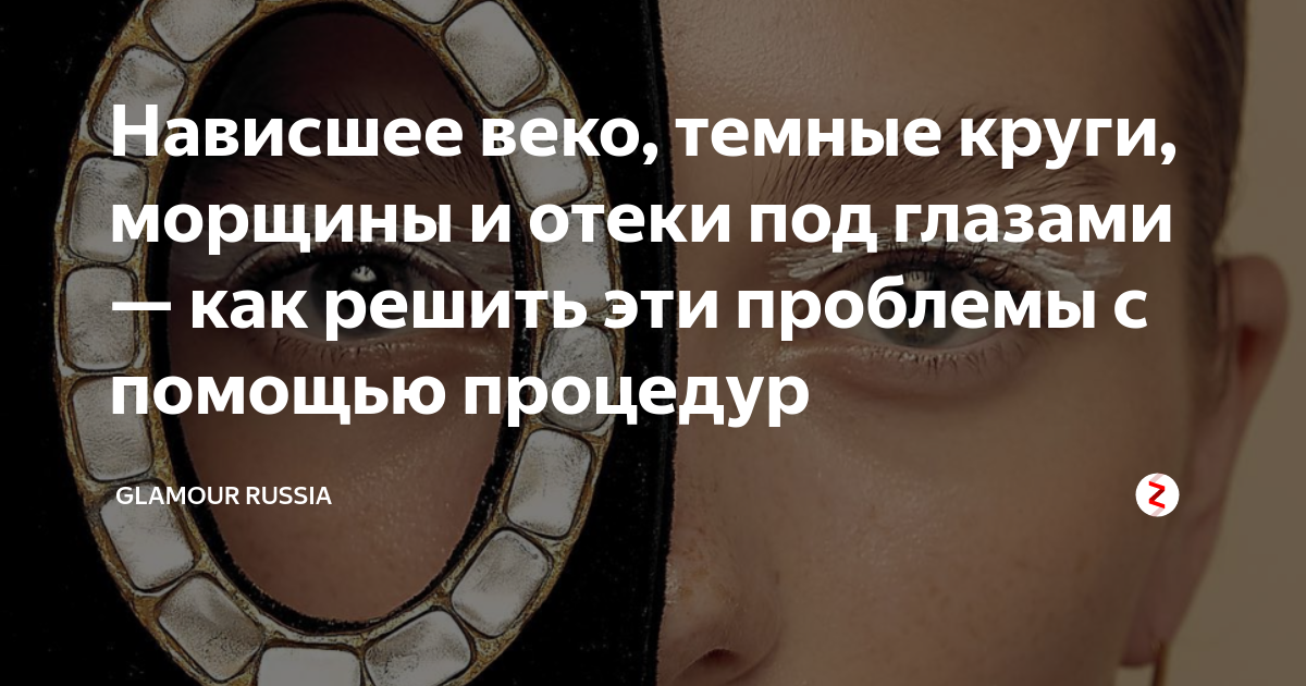 Темная кожа век причины. О чем говорят темные веки. Подкожные на верхних веках причины. Коричневые круги вокруг глаз. О чем говорят темные веки.