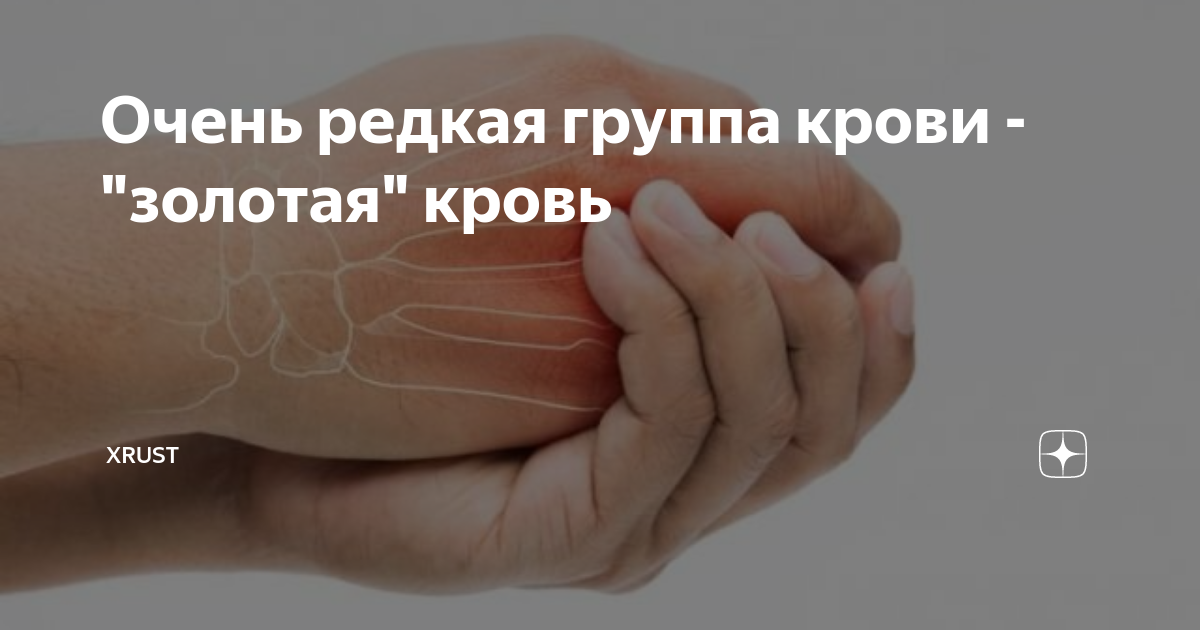 Золотая кровь у человека как выглядит Очень редкая группа крови - "золотая" кровь Xrust Дзен