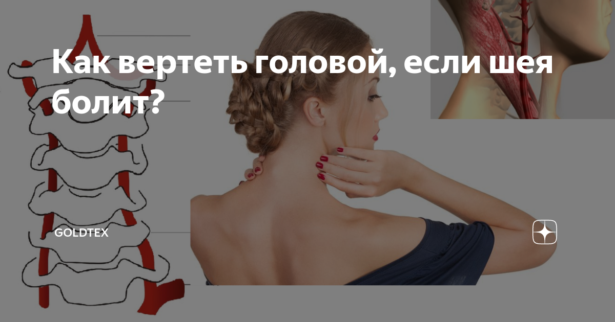 Болит шея что делать. Болит шея при повороте головы. Что делать если болит шея. Боли в шее и затылке при повороте