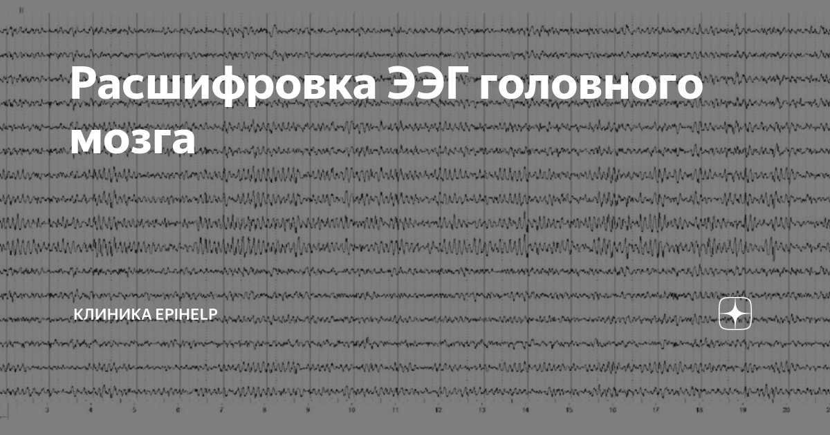 Расшифровка ЭЭГ головного мозга | Клиника Epihelp | Дзен