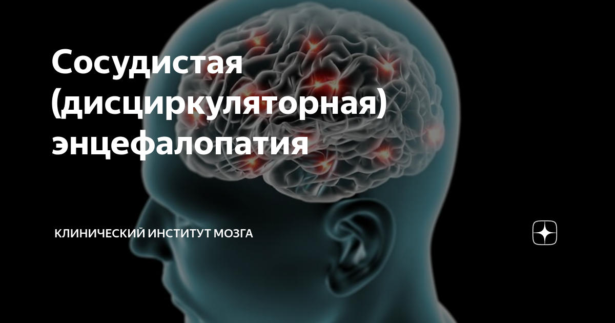 Дисциркуляторная энцефалопатия сколько можно прожить. Сосудистая энцефалопатия. Дисциркуляторная энцефалопатия. Дисциркуляторная энцефалопатия мрт.