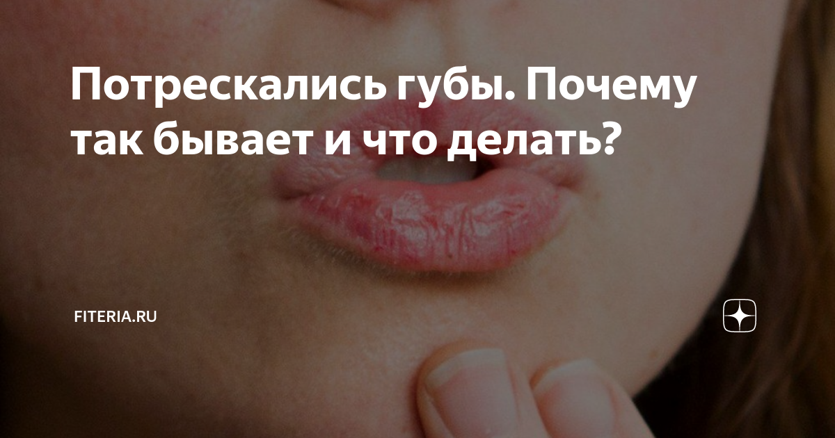 Почему трескаются губы? | Медицинский центр 